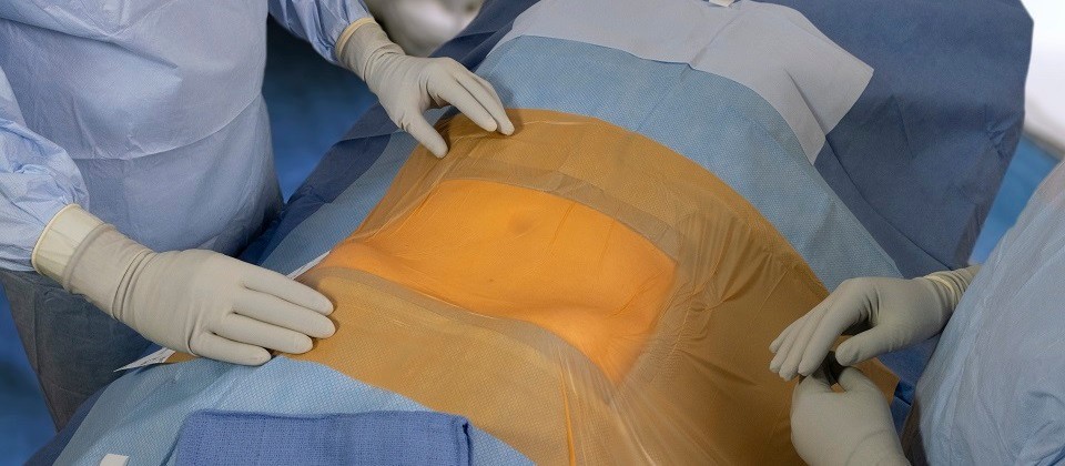 New Cardinal Health surgical drape helps reduce surgical site contamination risk
